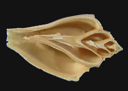 volutospina__spinosa_LAMARCK_miroe.jpg volutospina__spinosa_LAMARCK_miroe.jpg